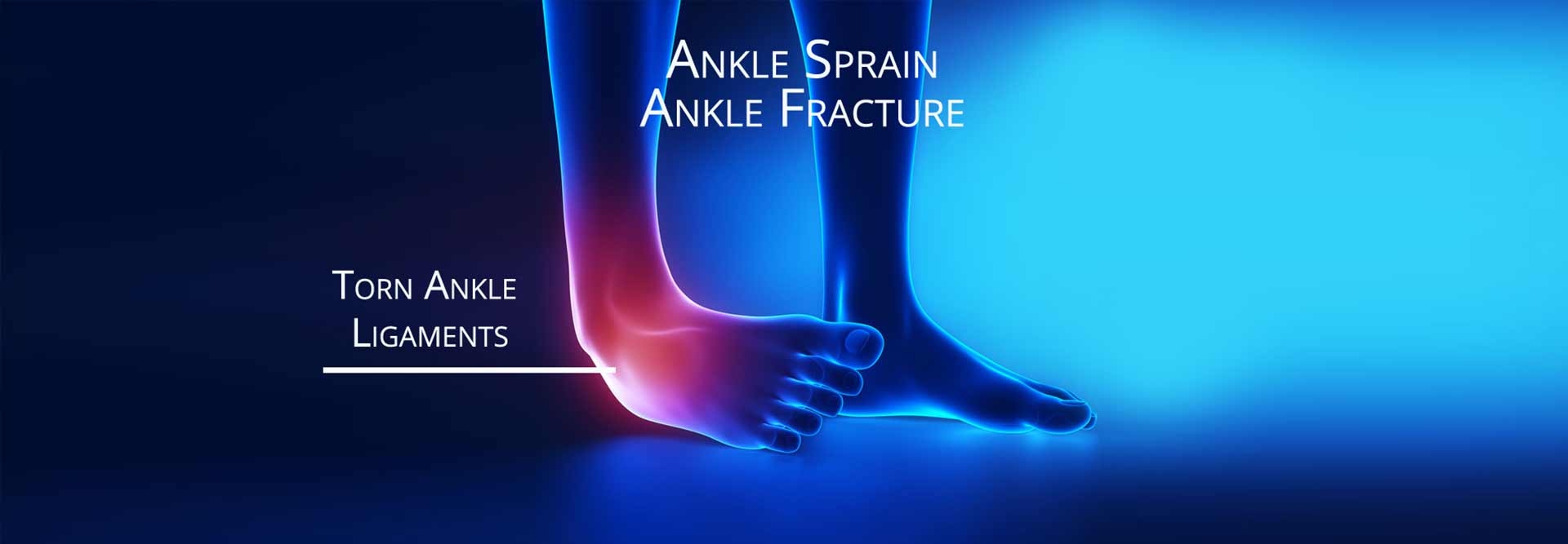 Ankle Sprain - Ankle Fracture - Torn Ligament or Tendon