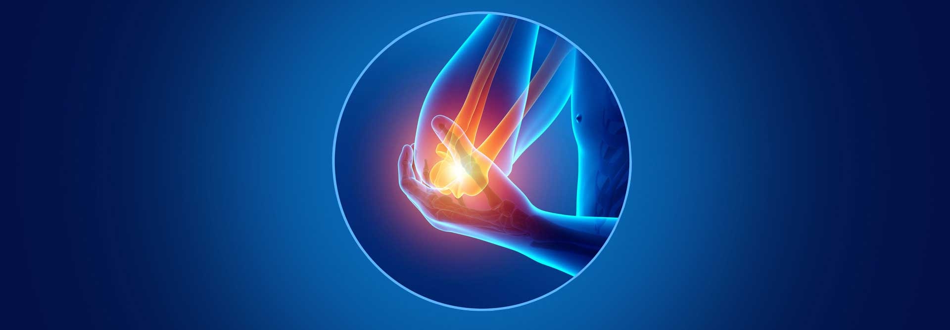 Elbow Pain - Tennis Elbow – Self-Healing Method - Self Healing Course