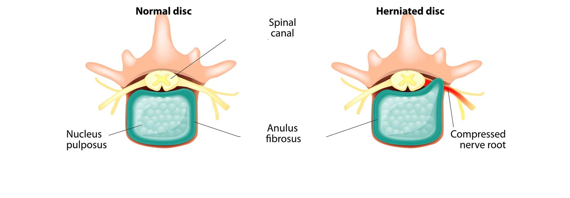 How energy medicine can help restore a person’s health - Energy healing therapy