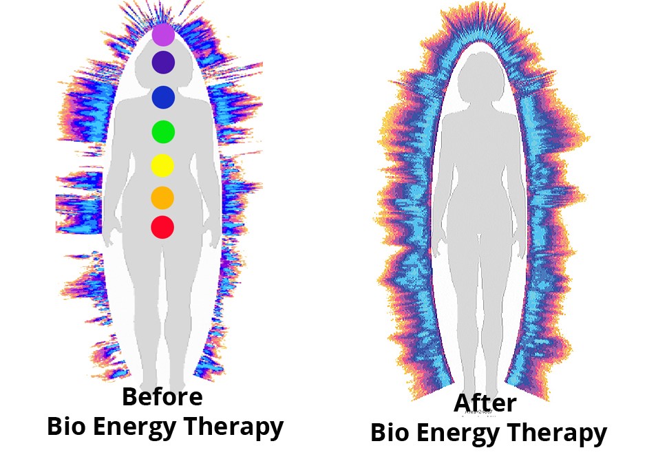 GDV image shows the energy field of a client prior to Bio Energy.